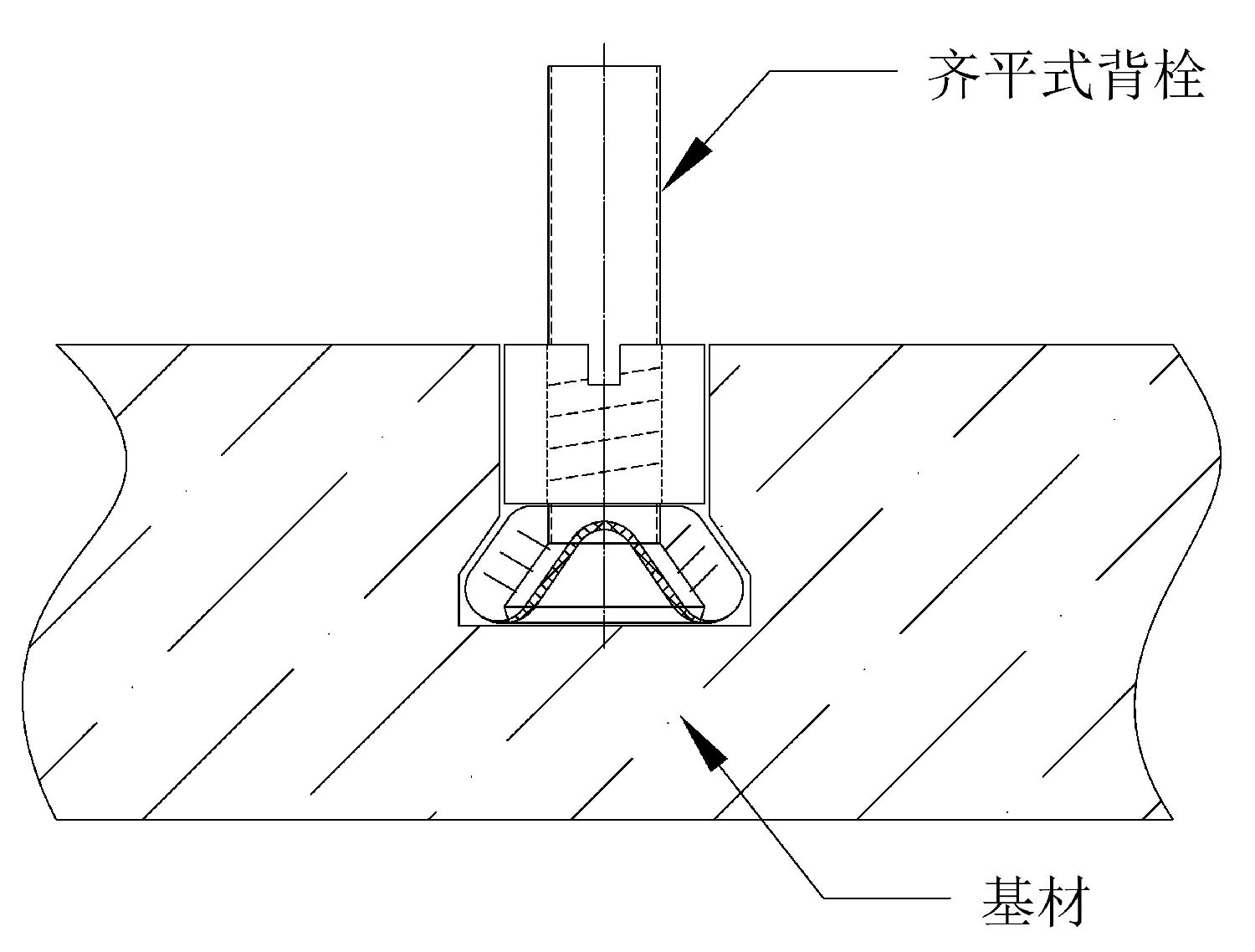 齐平式背栓